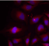 Polyclonal Rabbit anti-Human NFKB2 Antibody (IHC, IF, WB)