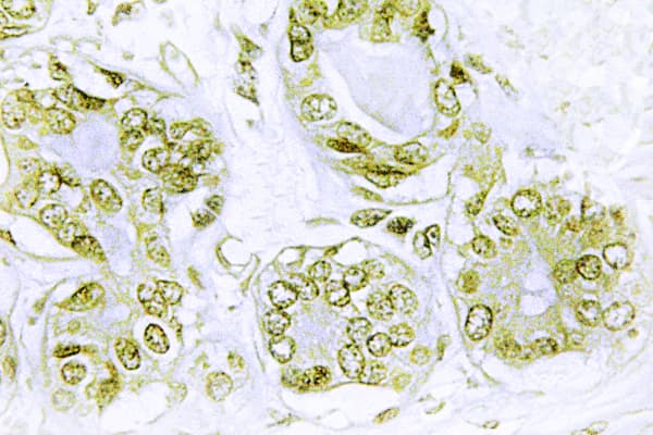 Polyclonal Rabbit anti-Human NFKBIA / IKB Alpha / IKBA Antibody (phospho-Tyr42, IHC)