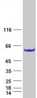 Human CCDC97 Protein (Recombinant Myc-DDK (Flag))