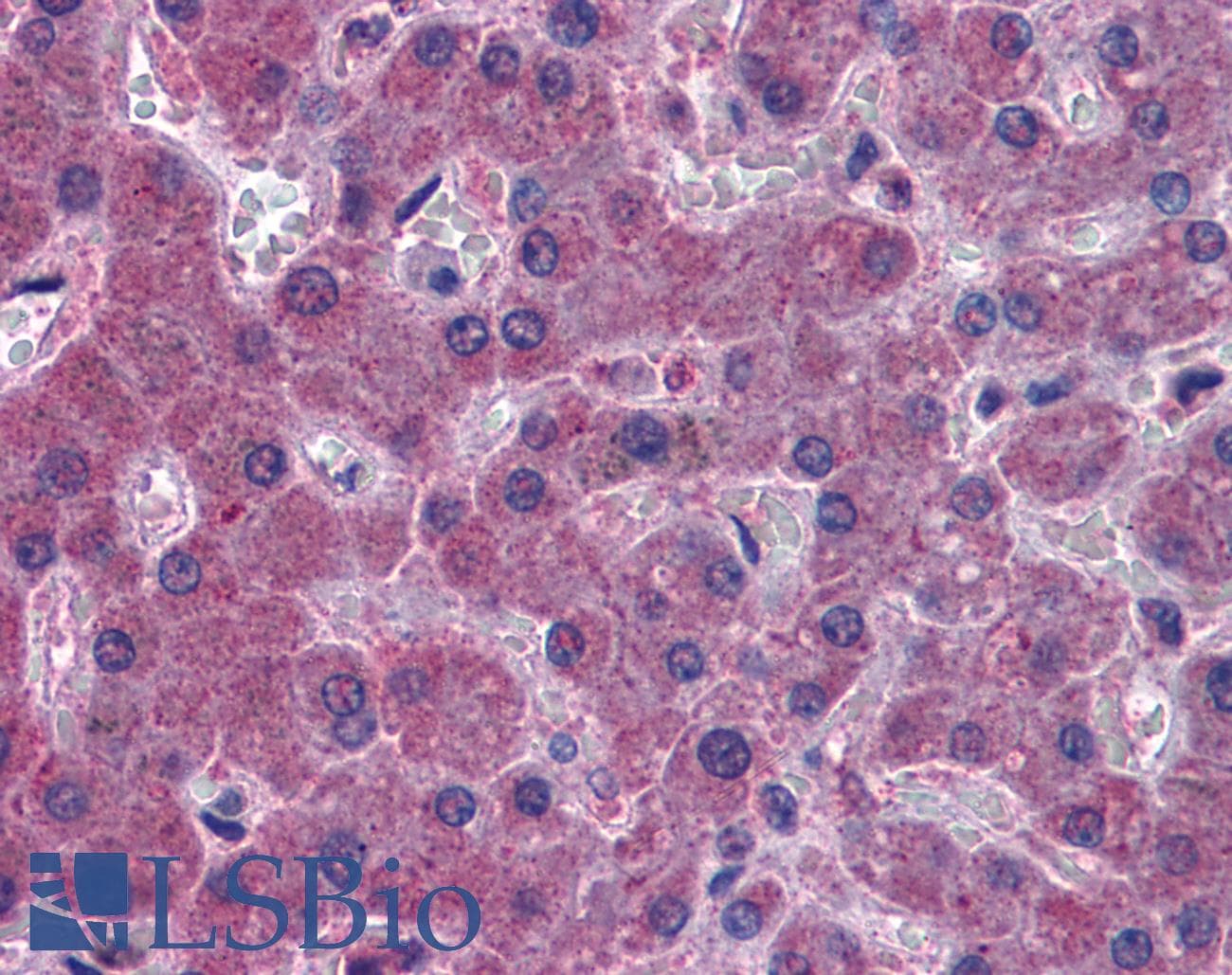 IHC-plus™ Polyclonal Goat anti-Human IREB2 / IRP2 Antibody (aa489-503, IHC, WB)