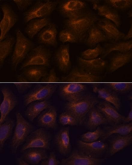 GPR22 Antibody