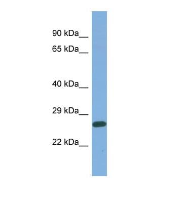 MED25 Antibody (C-Terminus)