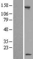 LSM7 Protein (Over-Expression Lysate Myc-DDK (Flag))