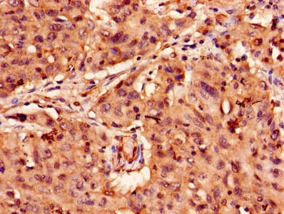 Polyclonal Rabbit anti-Human APAF1 / APAF-1 Antibody (IHC)