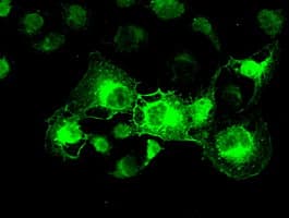 IHC-plus™ CRYAB / Alpha B Crystallin Antibody (clone 6D11)