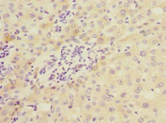 Polyclonal Rabbit anti-Human COMMD1 Antibody (IHC)