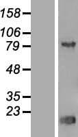 TRIP13 Protein (Over-Expression Lysate Myc-DDK (Flag))