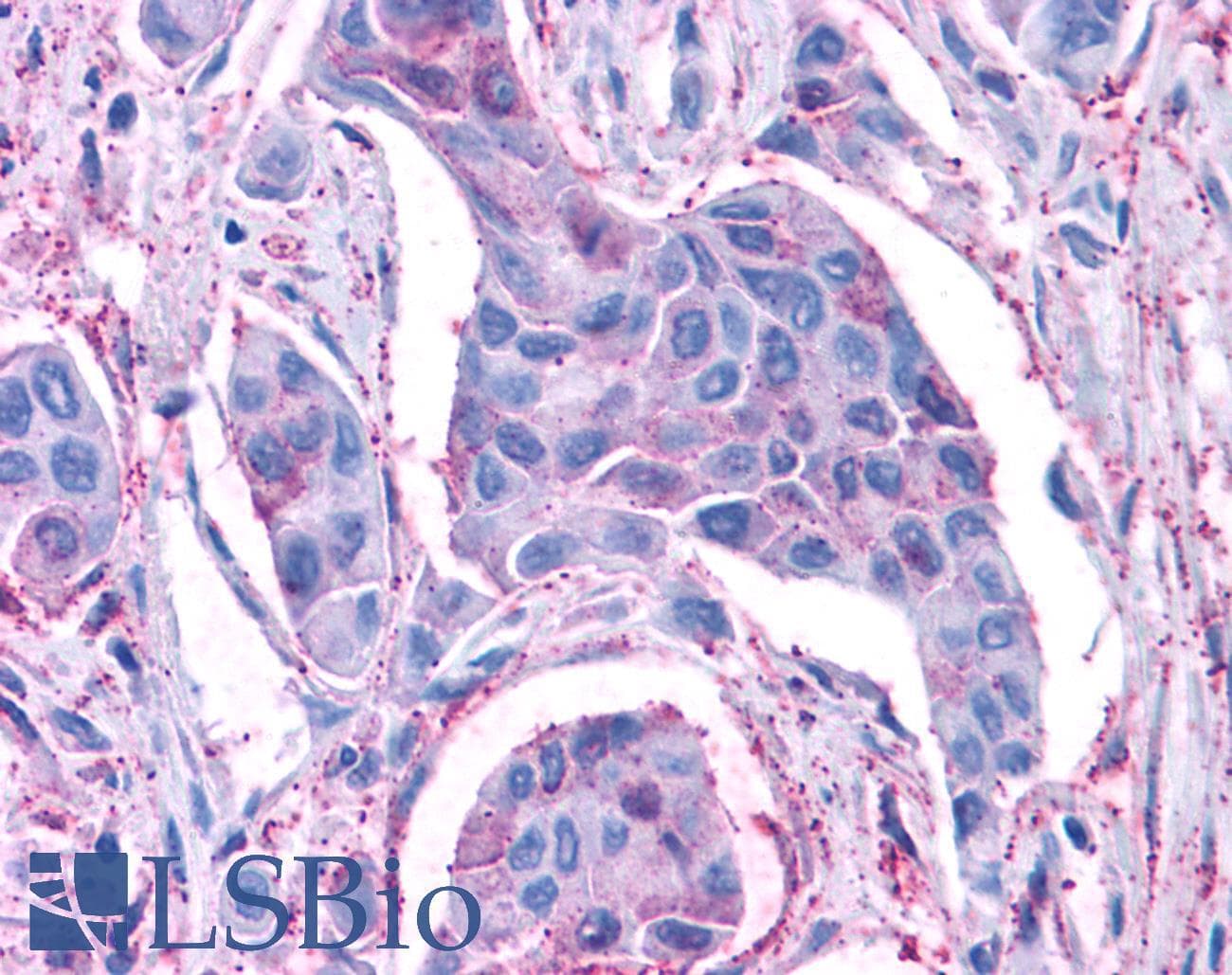 PathPlus™ PKD3 / PRKD3 Antibody (Internal)