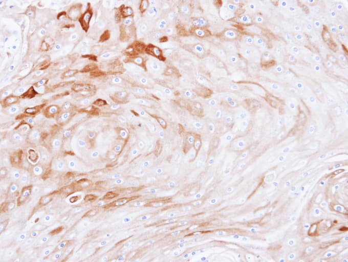 Polyclonal Rabbit anti-Human BCAT2 Antibody (aa1-332, IHC, WB)