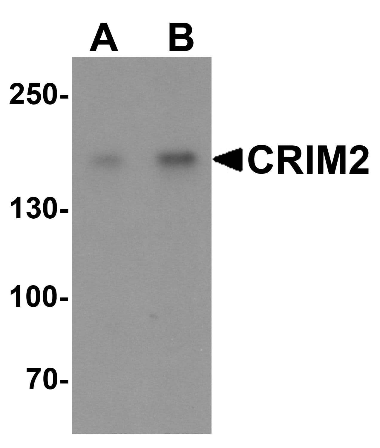 Polyclonal Rabbit anti-Human KCP / CRIM2 Antibody (WB)