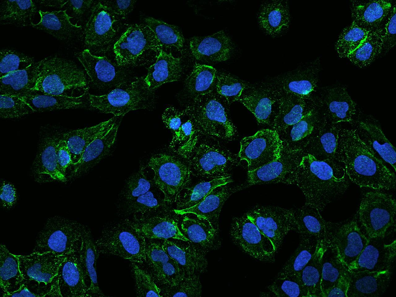 FAM198A Antibody
