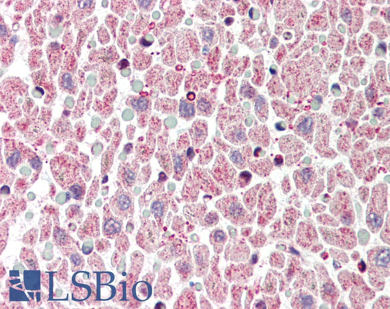 IHC-plus™ Polyclonal Rabbit anti-Human BCL2L1 / BCL-XL Antibody (IHC, WB)