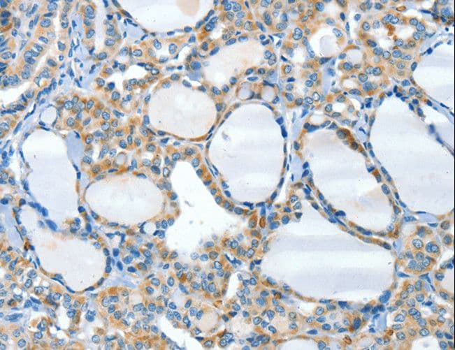 HID1 / C17orf28 Antibody