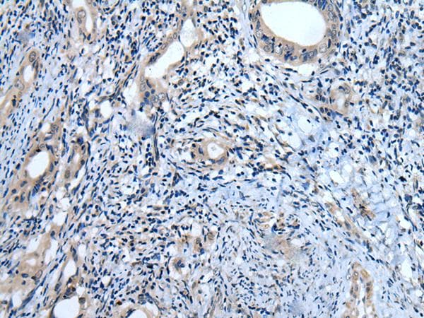 Polyclonal Rabbit anti-Human USP32 Antibody (IHC)