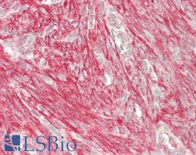 IHC-plus™ Polyclonal Rabbit anti-Human VCL / Vinculin Antibody (aa 2-235, IHC, WB)