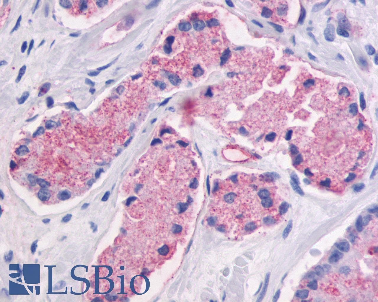 PathPlus™ Polyclonal Rabbit anti-Human GPR87 Antibody (C-Terminus, IHC)