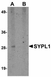 IHC-plus™ Polyclonal Rabbit anti-Human SYPL1 Antibody (IHC, WB)