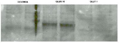 SLC2A10 / GLUT10 Antibody (aa367-385)