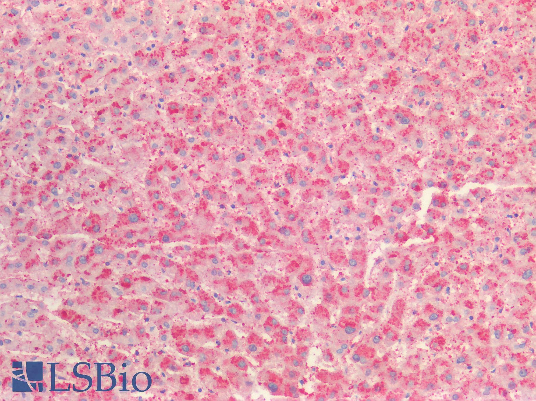 Prekallikrein Antibody (aa156-364)