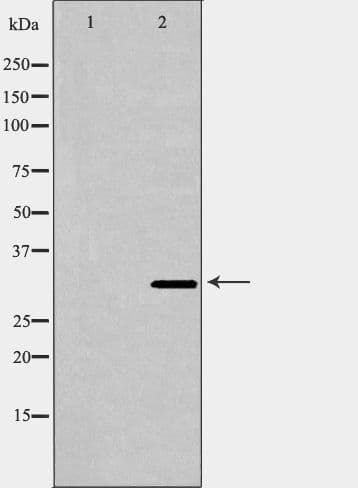 Polyclonal Rabbit anti-Human CAPZA2 / CAPZ Alpha 2 Antibody (IHC, WB)