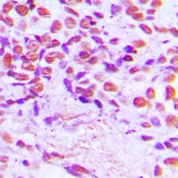 SENP3 Antibody (N-Terminus)