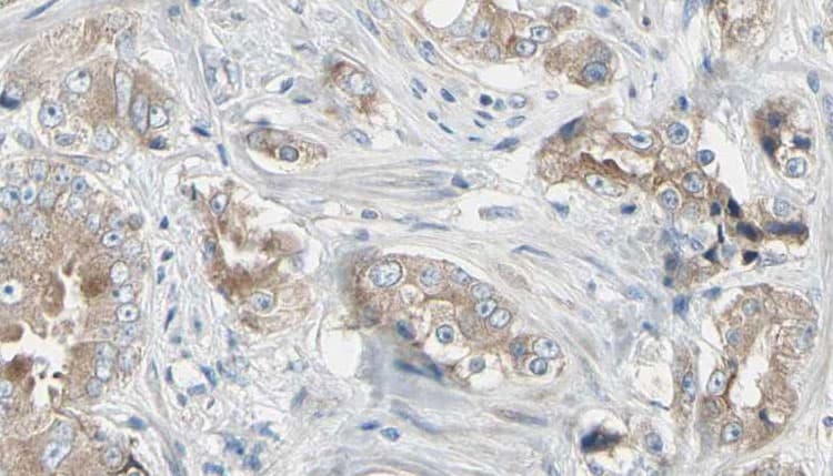 Polyclonal Rabbit anti-Human LRRK1 Antibody (IHC, WB)
