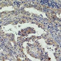 Polyclonal Rabbit anti-Human AKT2 Antibody (IHC, WB)