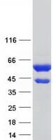 Human CAP1 Protein (Recombinant Myc-DDK (Flag))