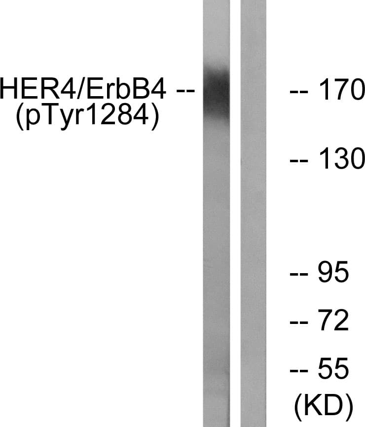 Polyclonal Rabbit anti-Human ERBB4 / HER4 Antibody (phospho-Tyr1284, IHC, IF, WB)
