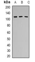 Polyclonal Rabbit anti-Human PRPF6 / TOM Antibody (C-Terminus, IHC, WB)