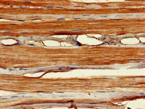 Polyclonal Rabbit anti-Human MYF6 / MRF4 Antibody (IHC, IF, WB)