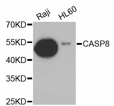 CASP8 / Caspase 8 Antibody