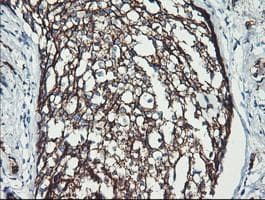 ERBB2 / HER2 Antibody (aa676-1255, clone OTI4F10, Carrier-free)