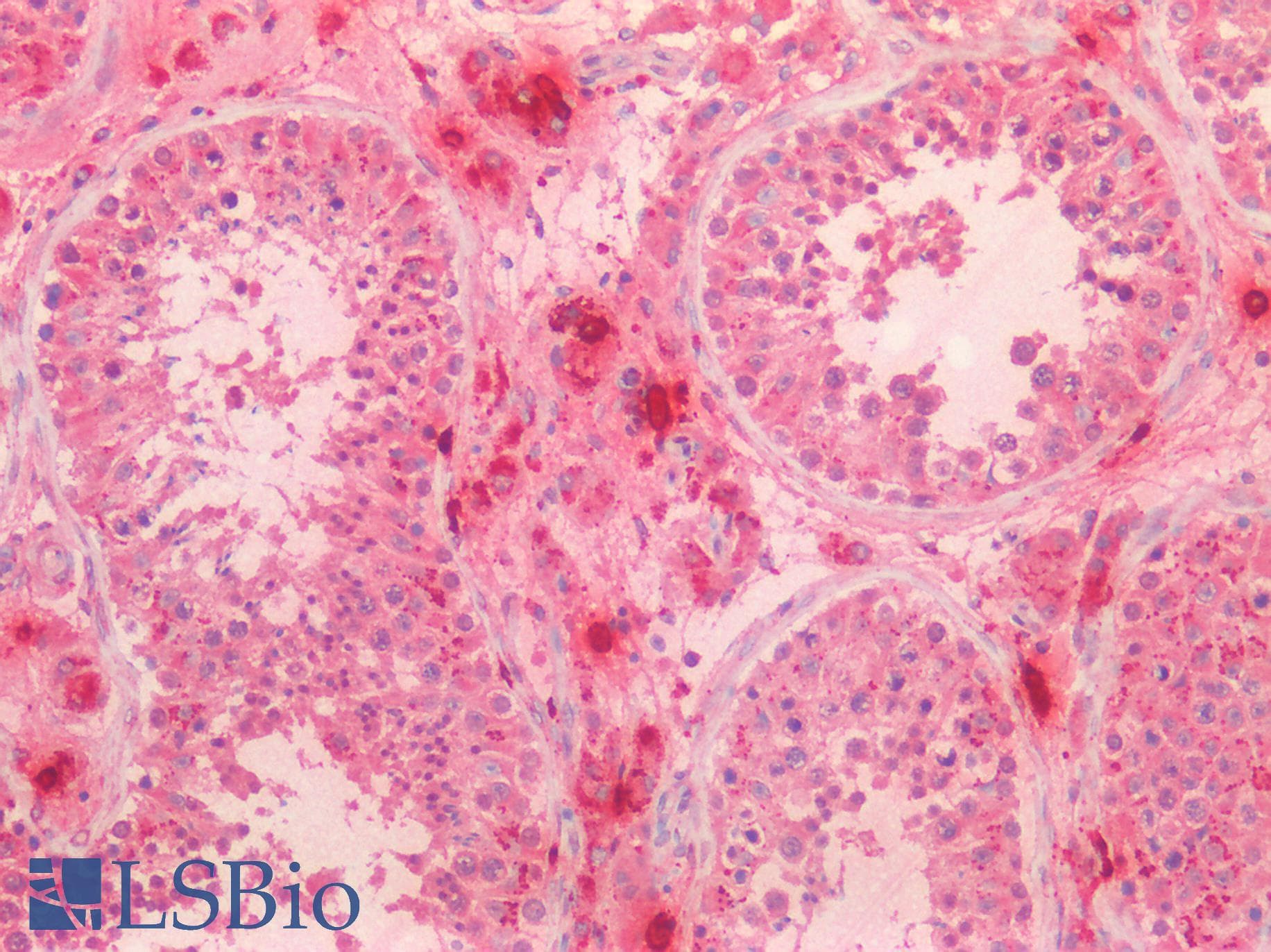 TPSAB1 / Mast Cell Tryptase Antibody (clone C16)