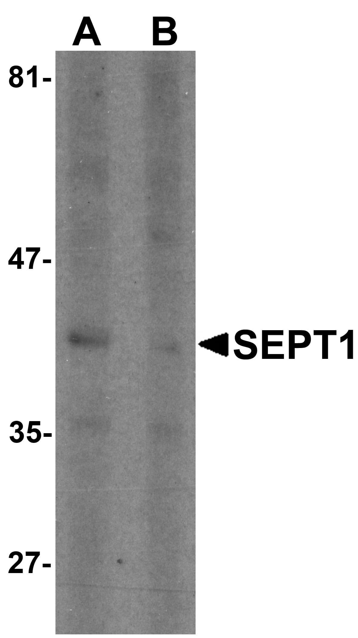 IHC-plus™ Polyclonal Rabbit anti-Human SEPT1 / Septin 1 Antibody (IHC, IF, WB)