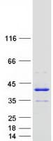 Human ANKRD54 / LIAR Protein (Recombinant Myc-DDK (Flag))