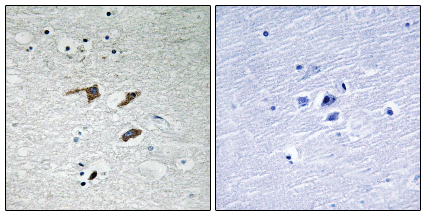 Polyclonal Rabbit anti-Human FAK / Focal Adhesion Kinase Antibody (aa543-592, IHC)
