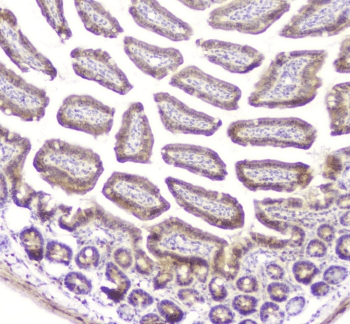 CHM / REP1 Antibody