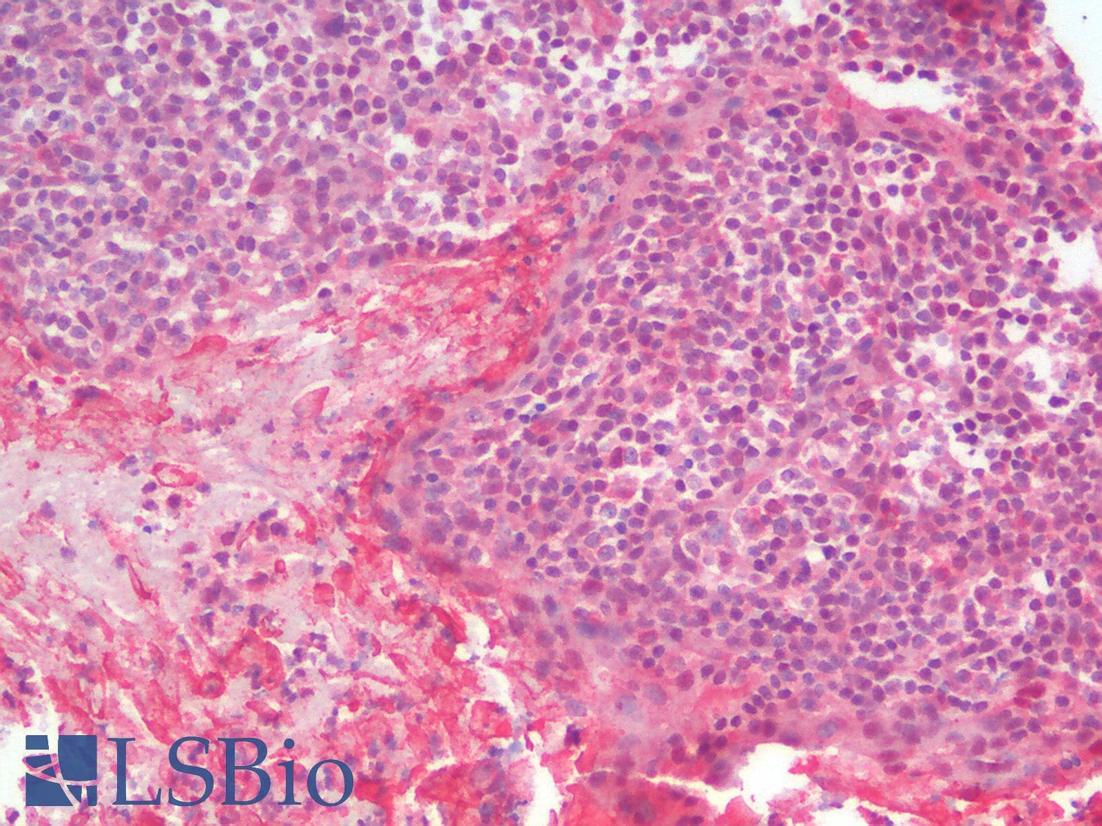 IHC-plus™ ANXA1 / Annexin A1 Antibody