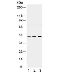 ELAVL4 / HuD Antibody
