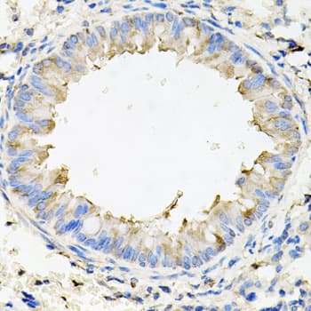 CALU / Calumenin Antibody