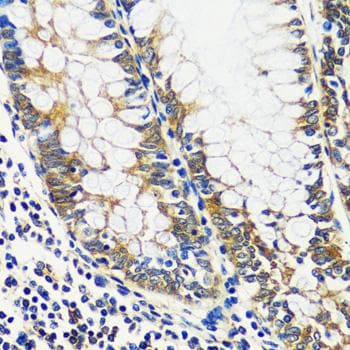 Polyclonal Rabbit anti-Human CCDC124 Antibody (IHC)