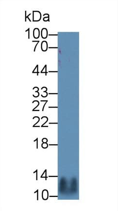 CCL5 / RANTES Antibody (aa24-91)