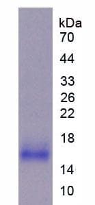 Mouse IL31 Protein (Recombinant His-T7)