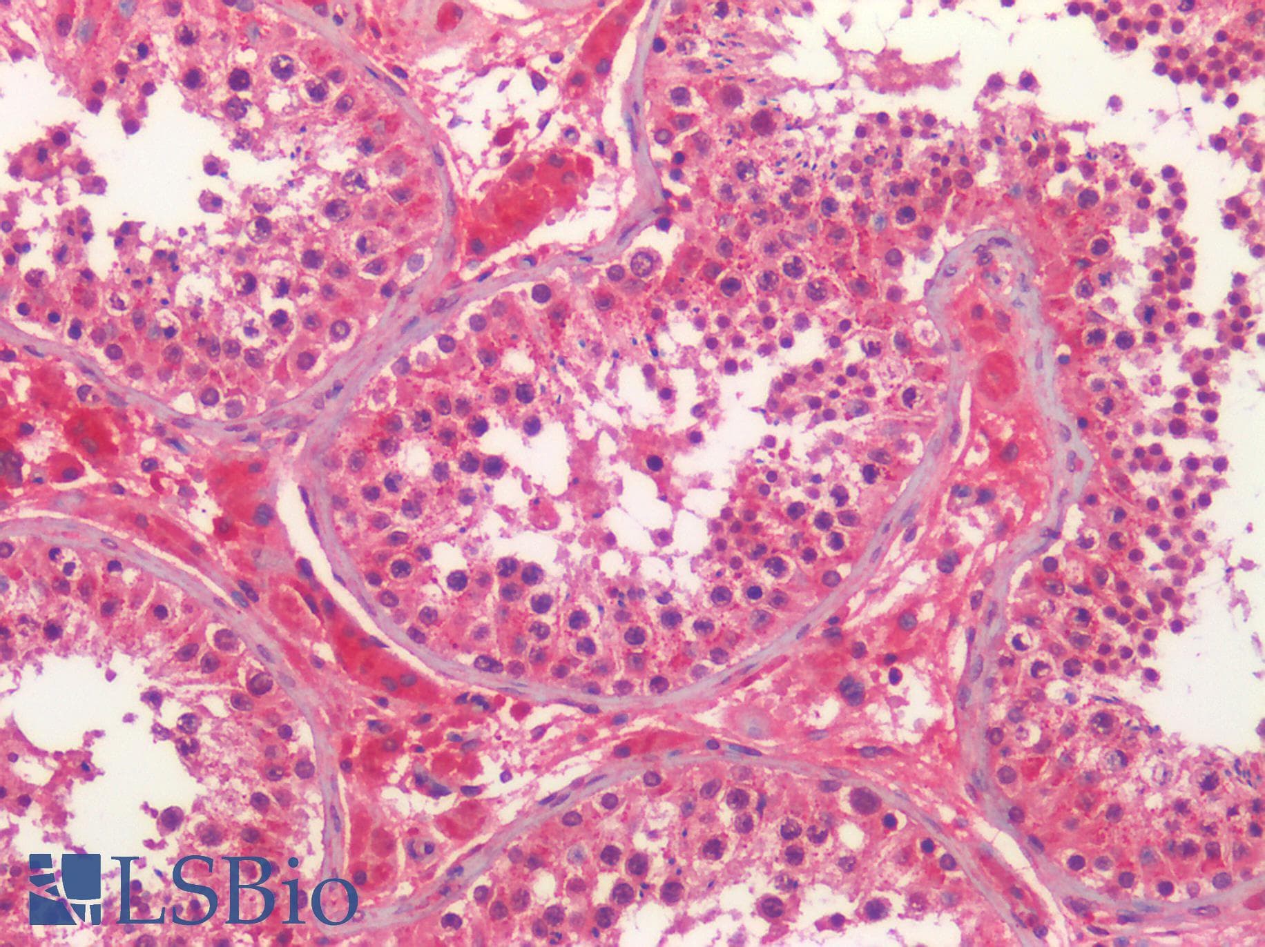 IHC-plus™ PGES / PTGES Antibody (N-Terminus)