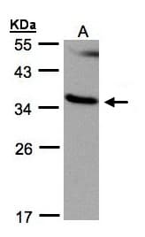 RASSF1 / RASSF1A Antibody (aa50-344)