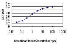 FLT4 / VEGFR3 Antibody (clone 5B6)