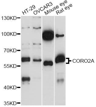 Polyclonal Rabbit anti-Human CORO2A Antibody (WB)