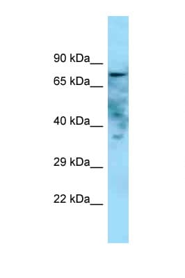 GOLIM4 / GPP130 Antibody (aa514-563)