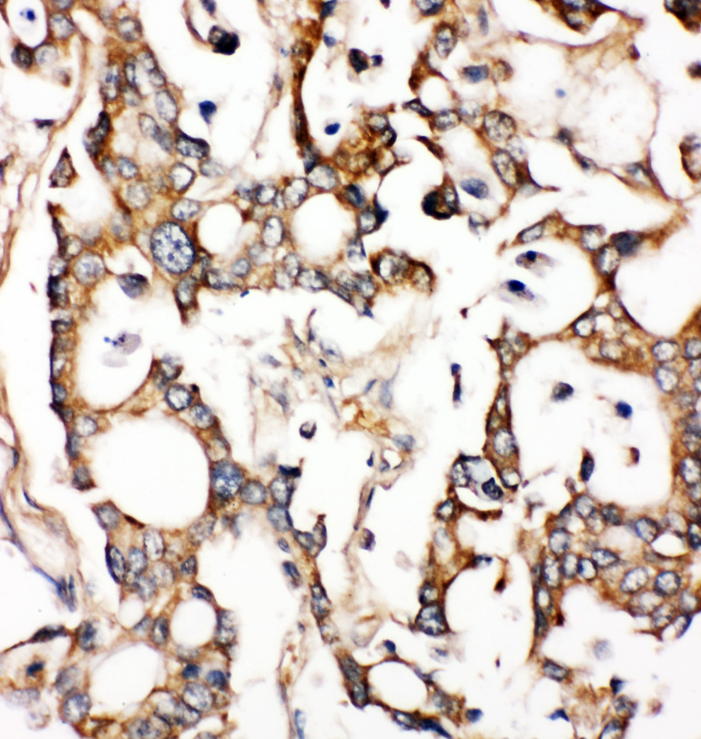Polyclonal Rabbit anti-Human ALDH2 Antibody (aa18-33, IHC, WB)